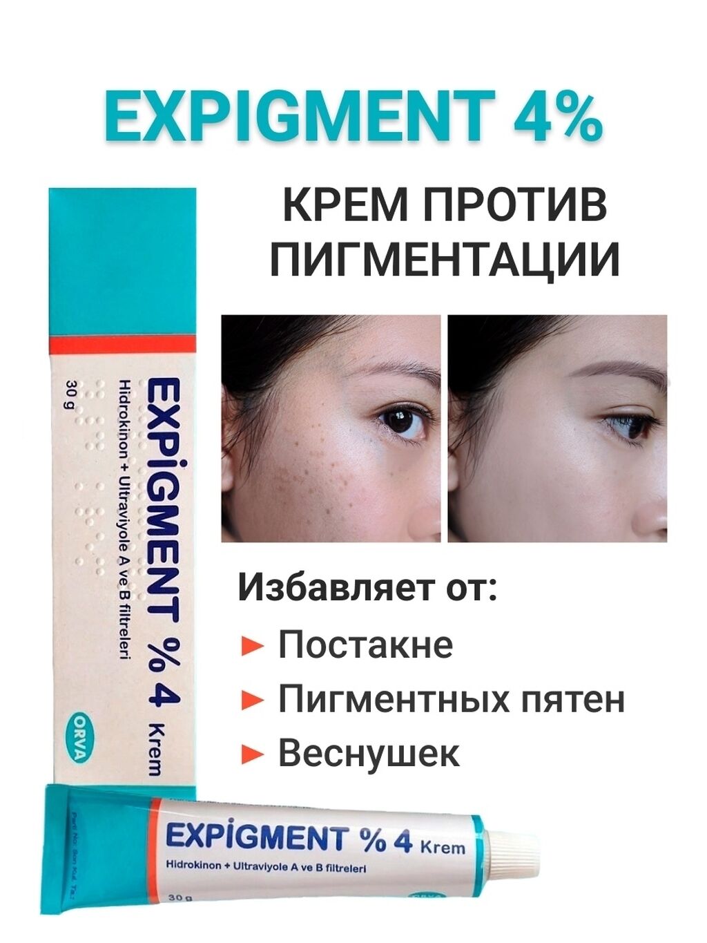 Expigment 4 Купить В Москве