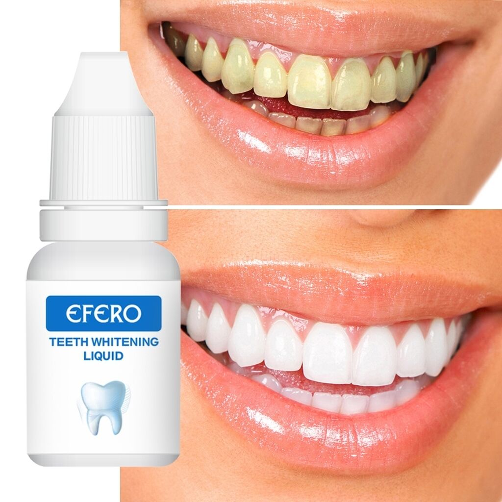 Teeth whitening отзывы. White Teeth гель для отбеливания. Эссенция efero для отбеливания зубов. Efero отбеливающая сыворотка для зубов гель.