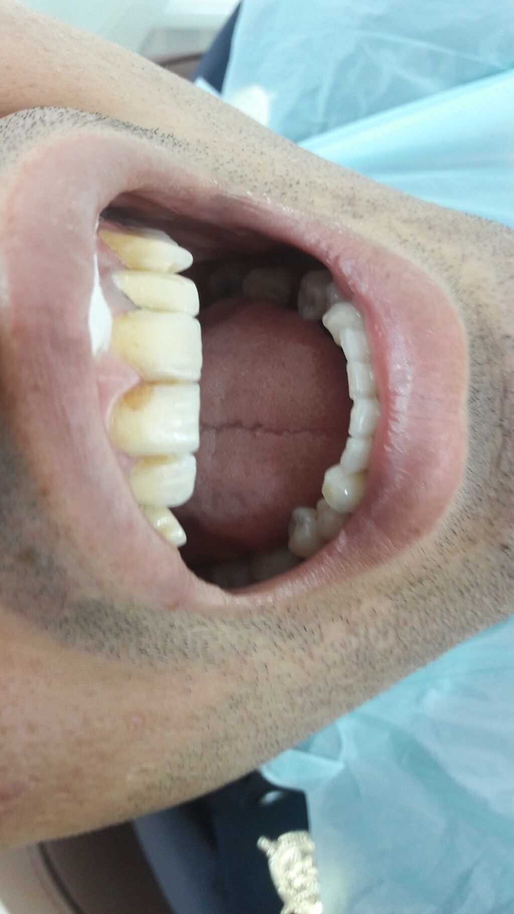 Peşəkar stomatoloji xidmətlər - 5