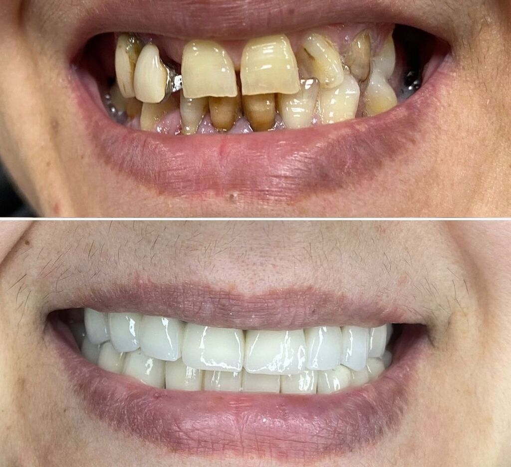 Peşəkar stomatoloji xidmətlər - 6