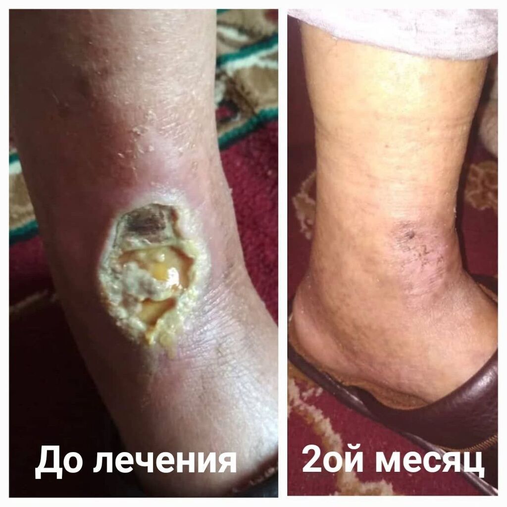 Врачи | Дерматолог | Диагностика, Консультация: фото 5