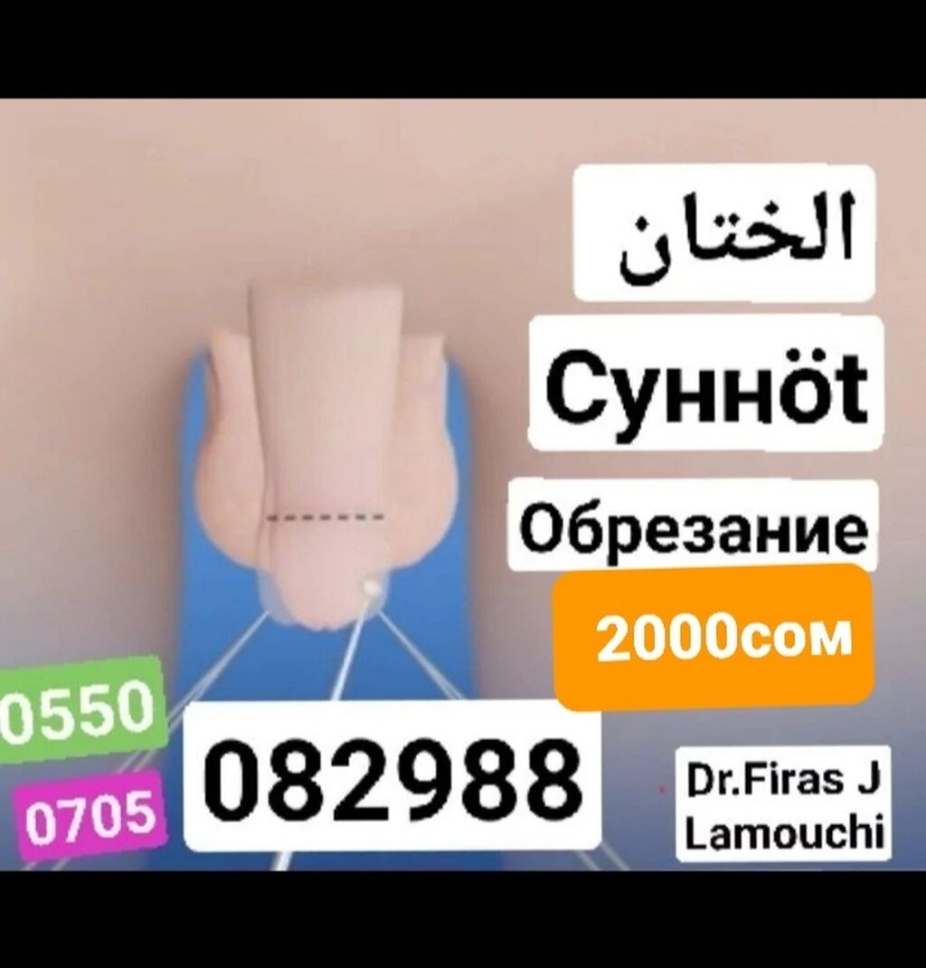 Обрезание . Сунно́т . circumcision . الختان 🩸без: 2000 KGS ᐈ Медицинские  услуги | Бишкек | 105362461 ➤ lalafo.kg