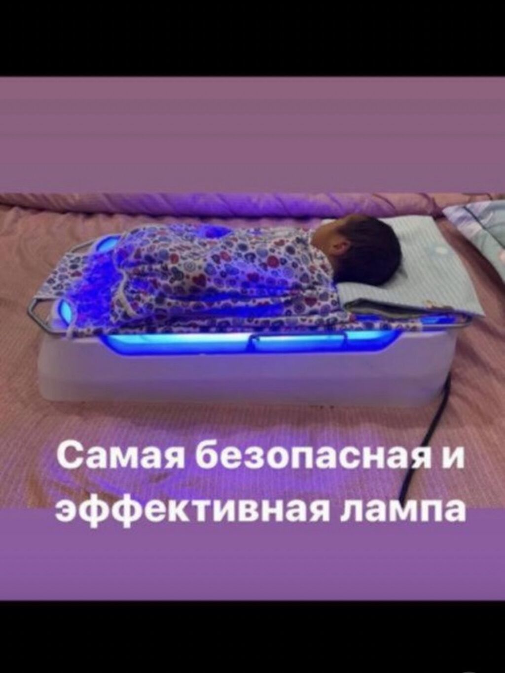 Фотолампа от желтухи для новорожденных: фото 4