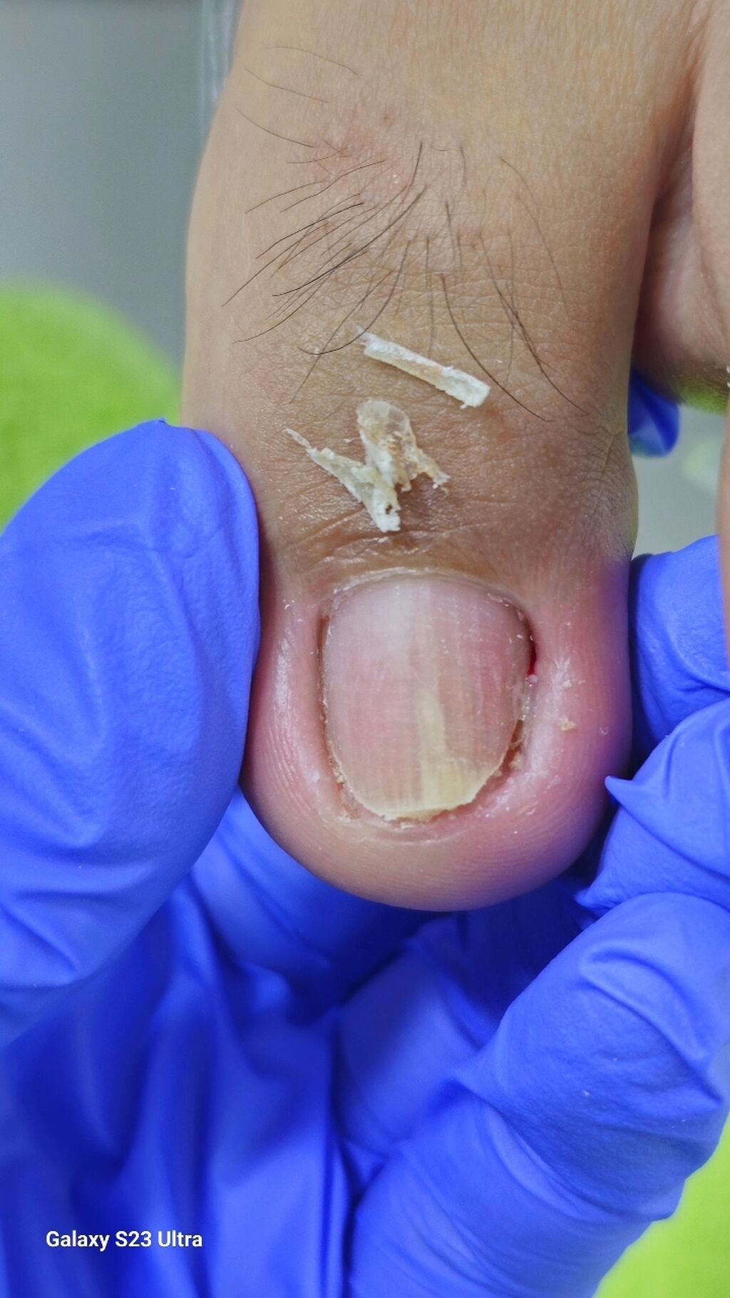 Выравнивание, Дизайн, Наращивание ногтей, Маникюр, Педикюр, Услуги подолога, Консультация, Одноразовые расходные материалы, Требуются модели — фото 4