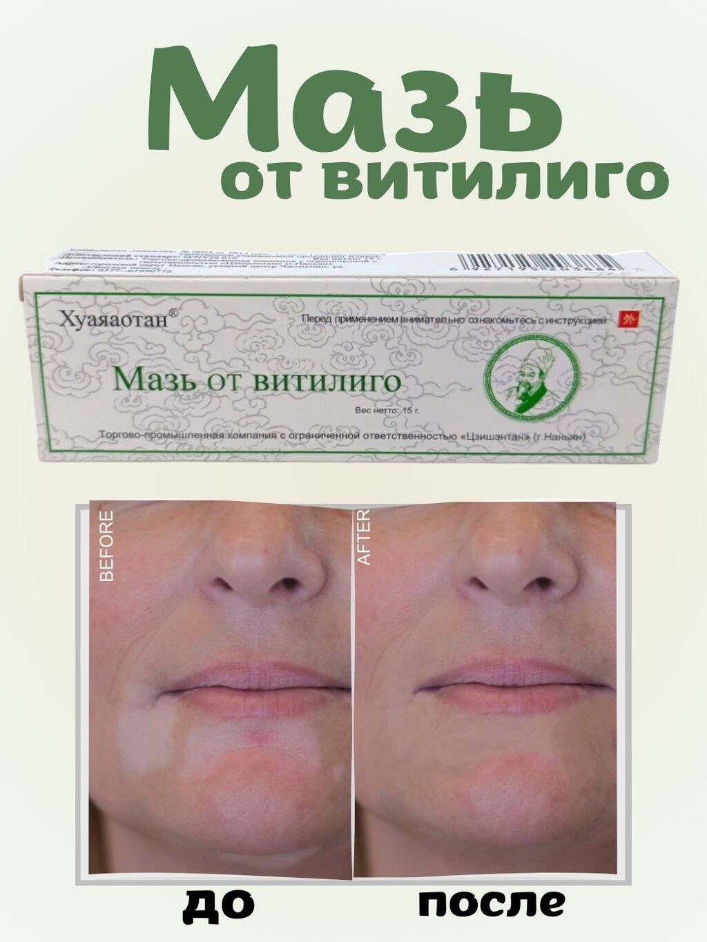Мазь от Витилиго Хуаяаотан - Восстановите Цвет Кожи и Устраните: фото 2