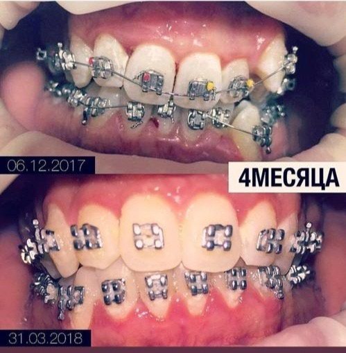 Мода, красота и здоровье: на lalafo.kg в Бишкек