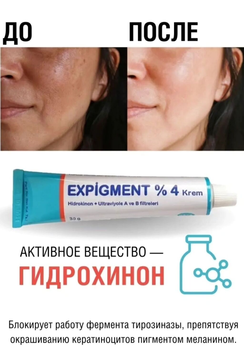 Expigment Крем Купить В Краснодаре