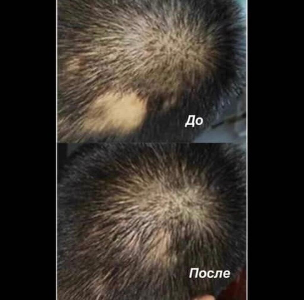 Спрей от выпадения волос от алопеции от лысины для роста, густоты — фото 6