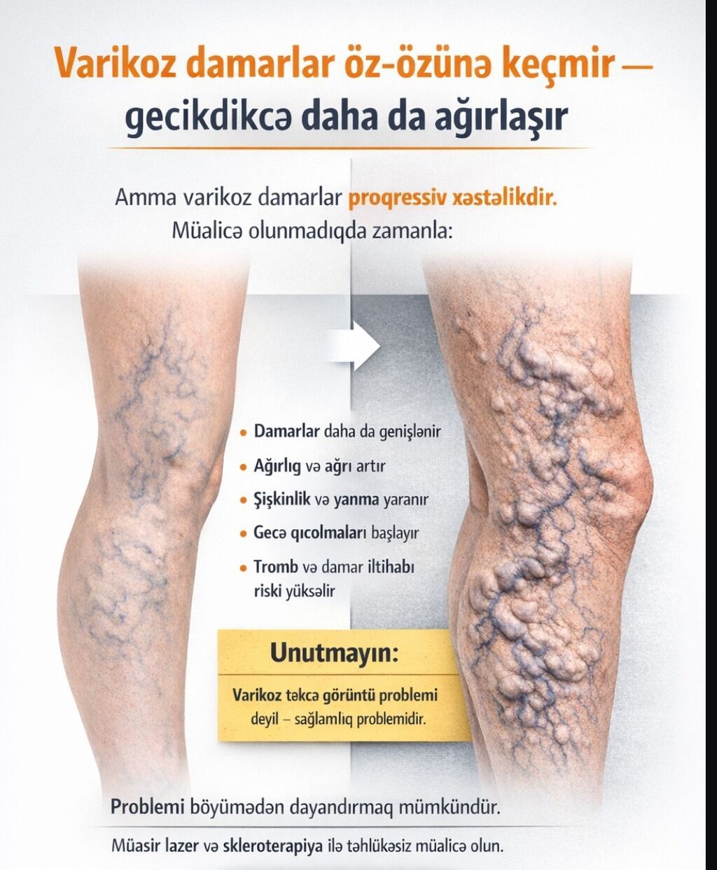 Klinikada varikoz damar müalicəsi - 4