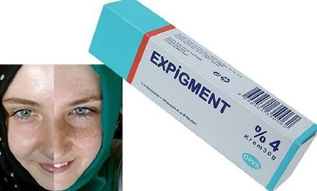 Expigment Крем Купить В Москве