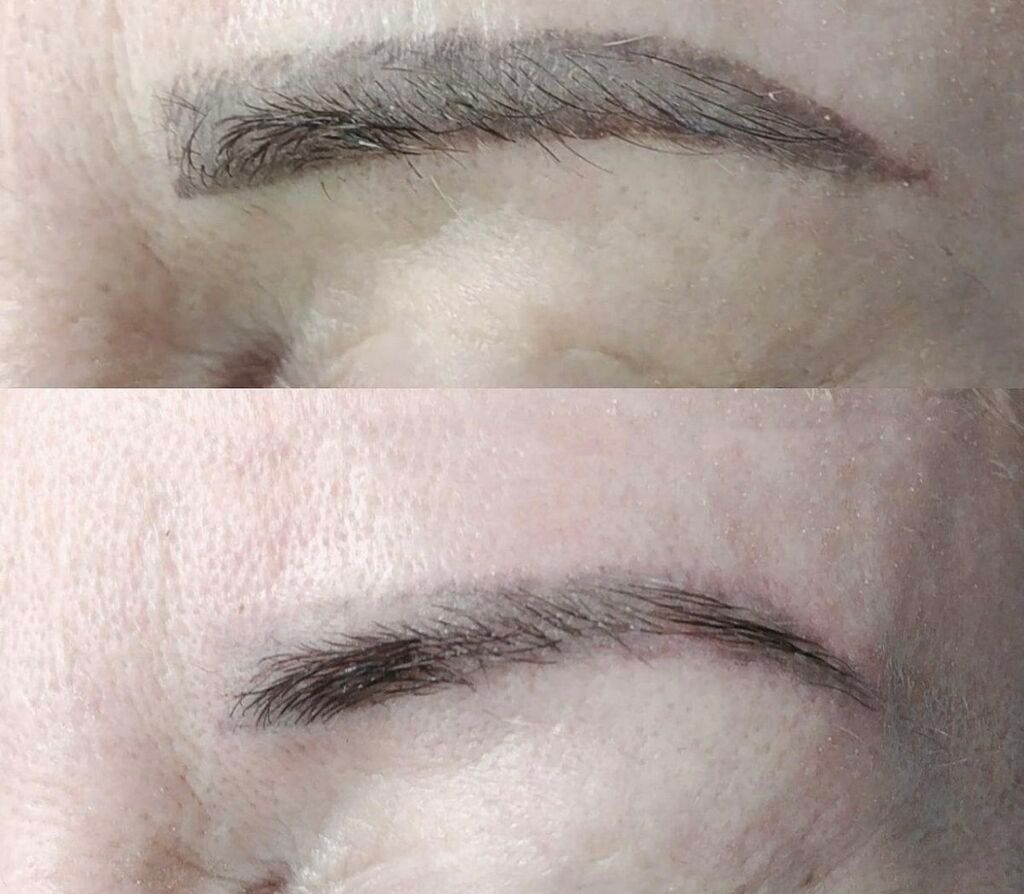 Удаление старого татуажа Ремувером Быстрая и: 800 KGS ᐈ Брови | Бишкек ...