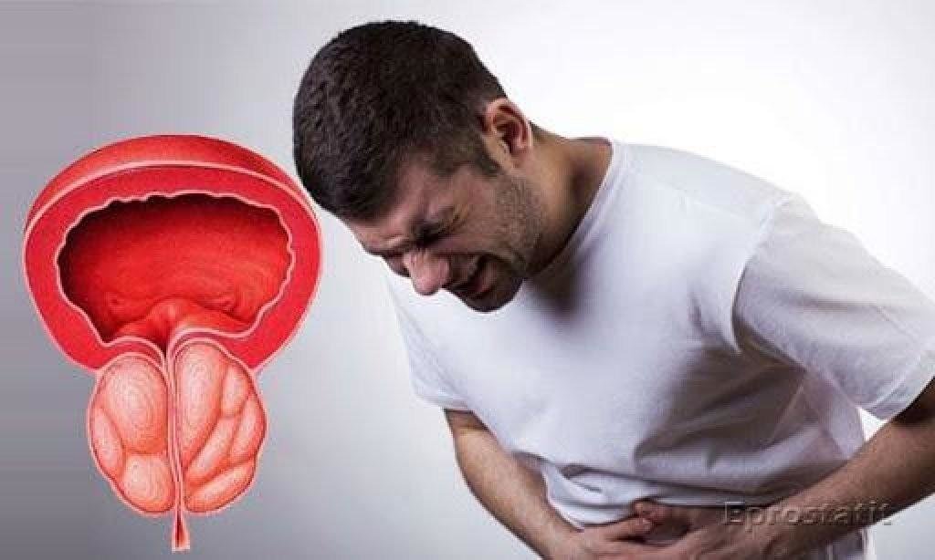 Простатиты У Мужчин Признаки Симптомы Фото