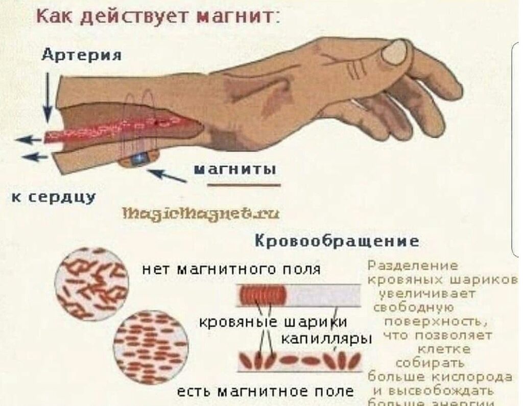 Принципы магнитотерапии. Принцип действия магнитотерапии на организм человека. Механизм действия магнитотерапии на организм человека. Магнитотерапия как работает. Воздействие магнитотерапии.