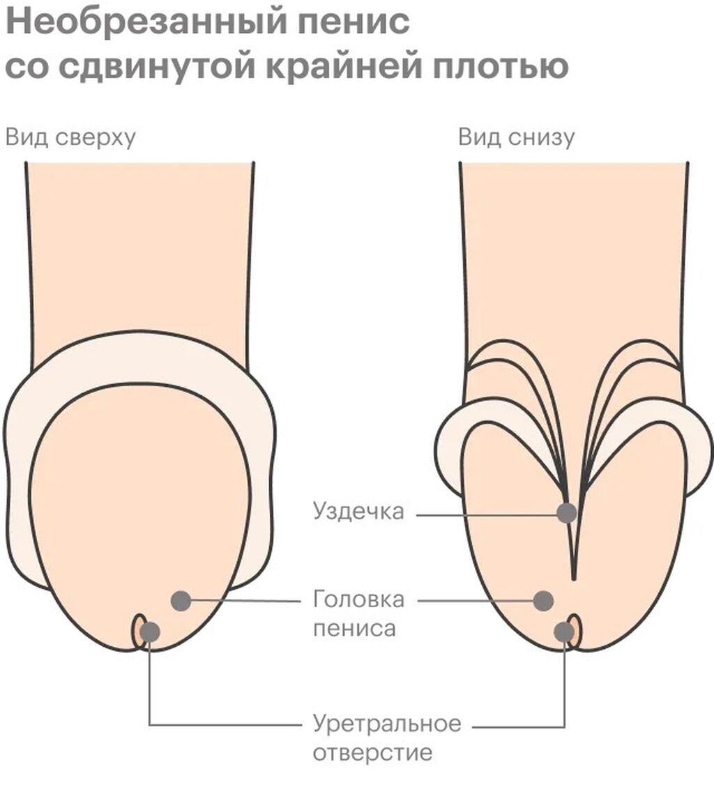 влияет ли обрезание на размеры члена фото 113