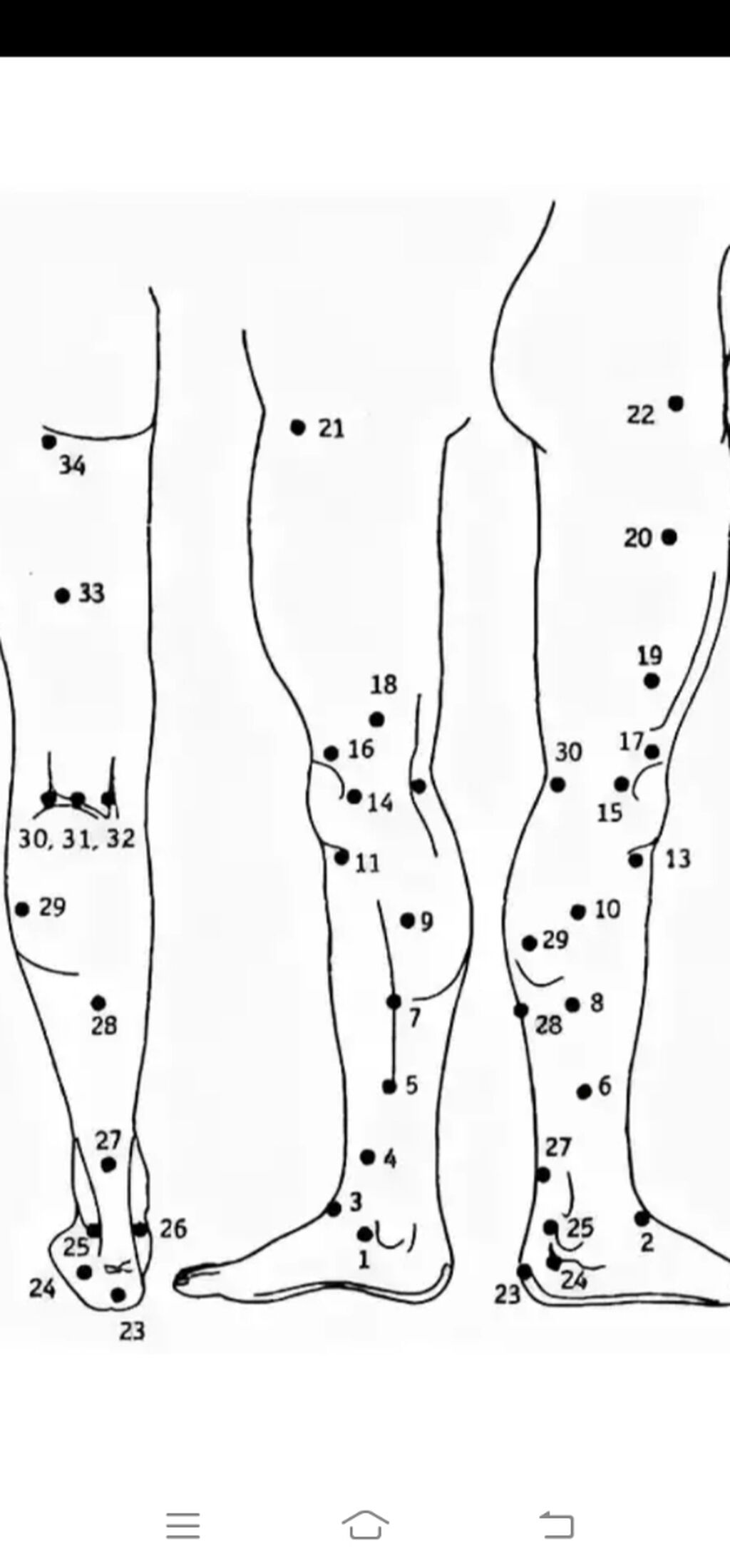 21 точка. Точки постановки пиявок на ноги варикоз. Точки постановки пиявок на ноги схема. Схема постановки пиявок на ноги. Акупунктура точки на голени.