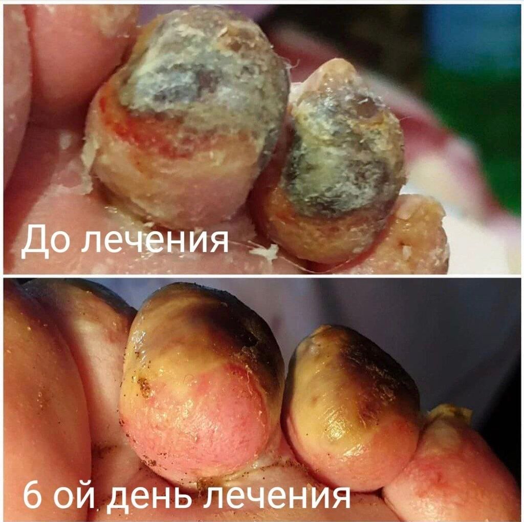 Врачи | Дерматолог | Диагностика, Консультация: фото 4