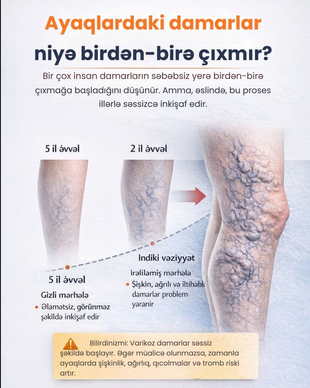 Klinikada varikoz damar müalicəsi - 5