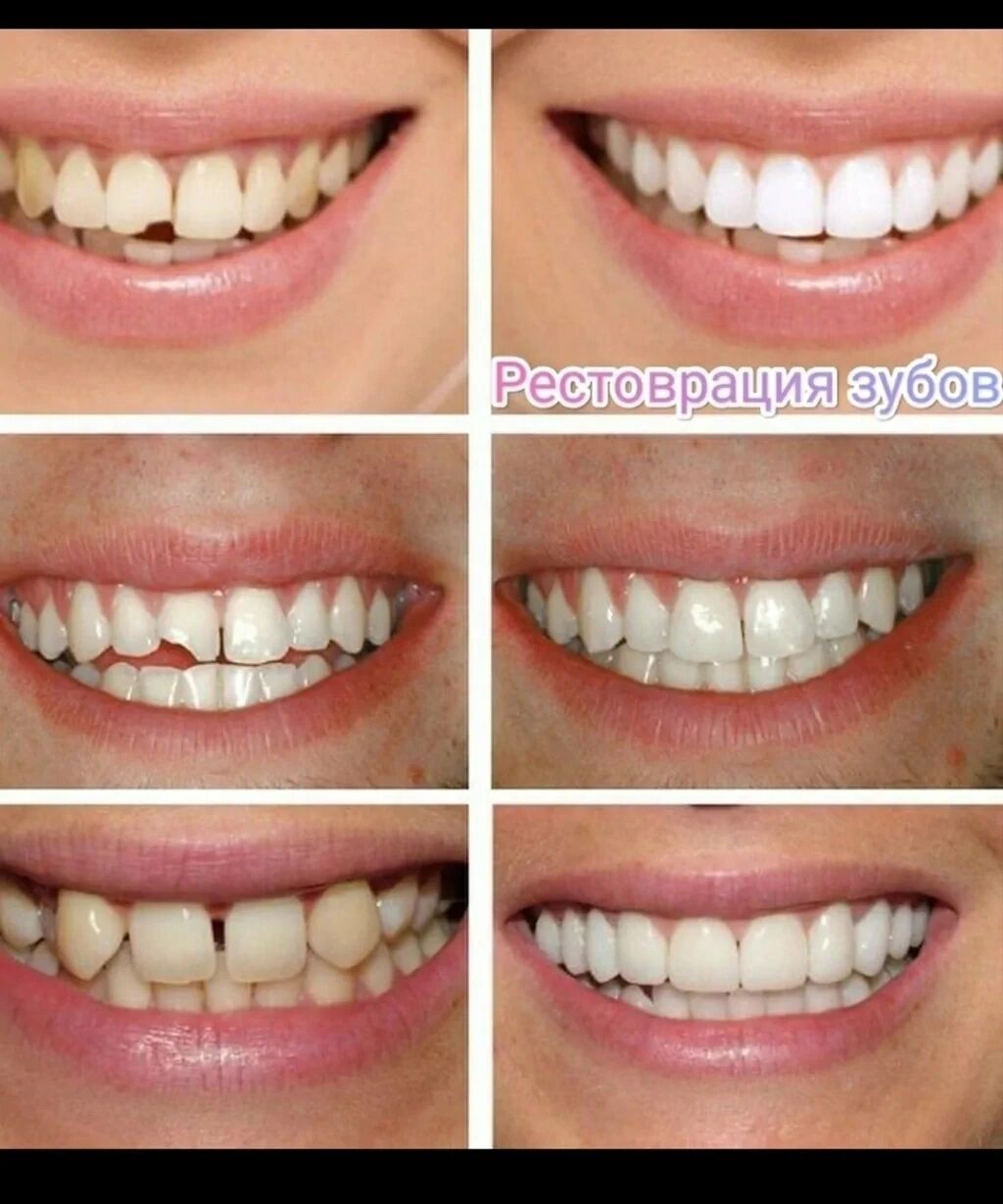 Быть идеально ровной. Красивые ровные зубы. Красивая форма зубов. Форма зубов и улыбка.