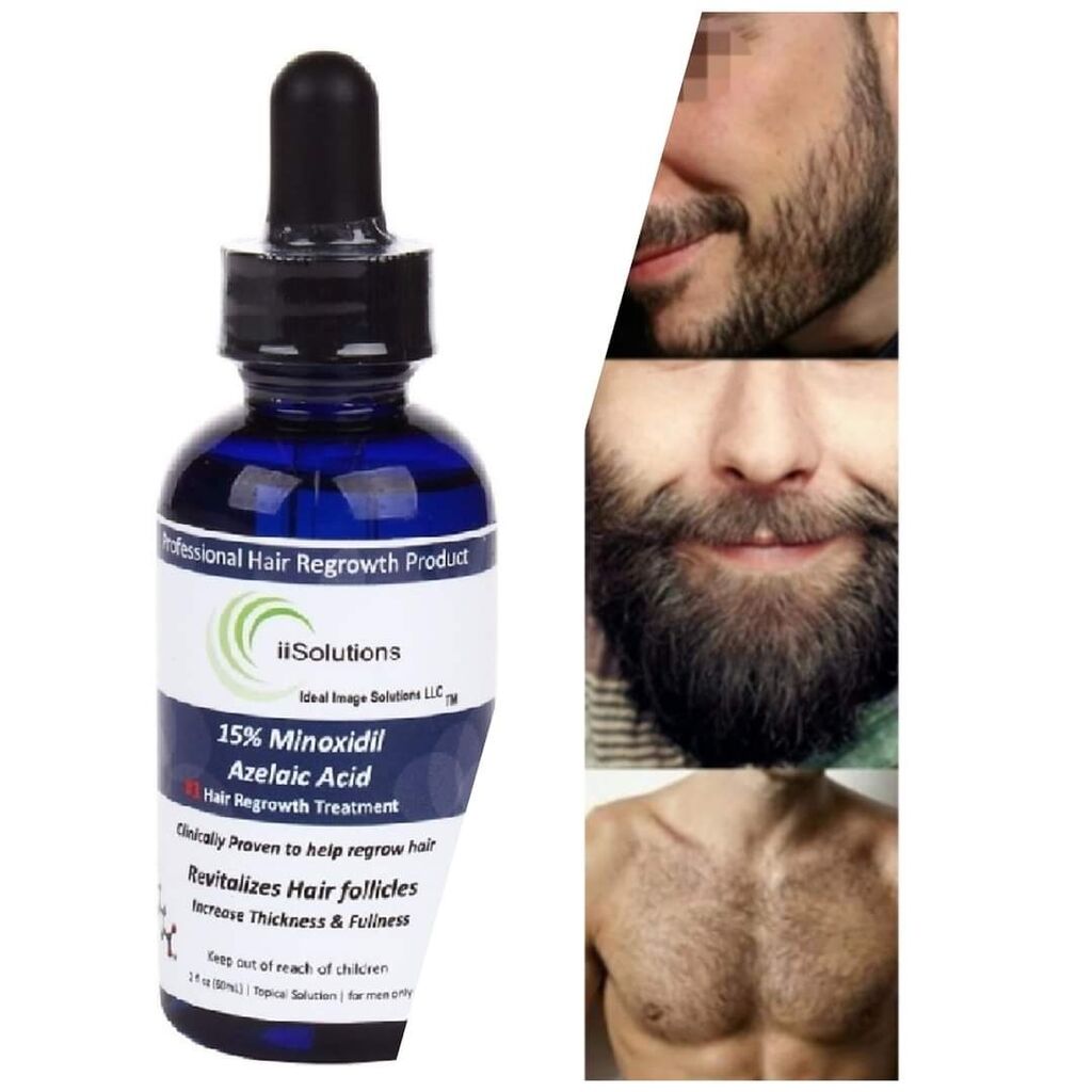 МИНОКСИДИЛ 15% Minoxidil **iiSolutions 15%** является: Договорная Уход ...