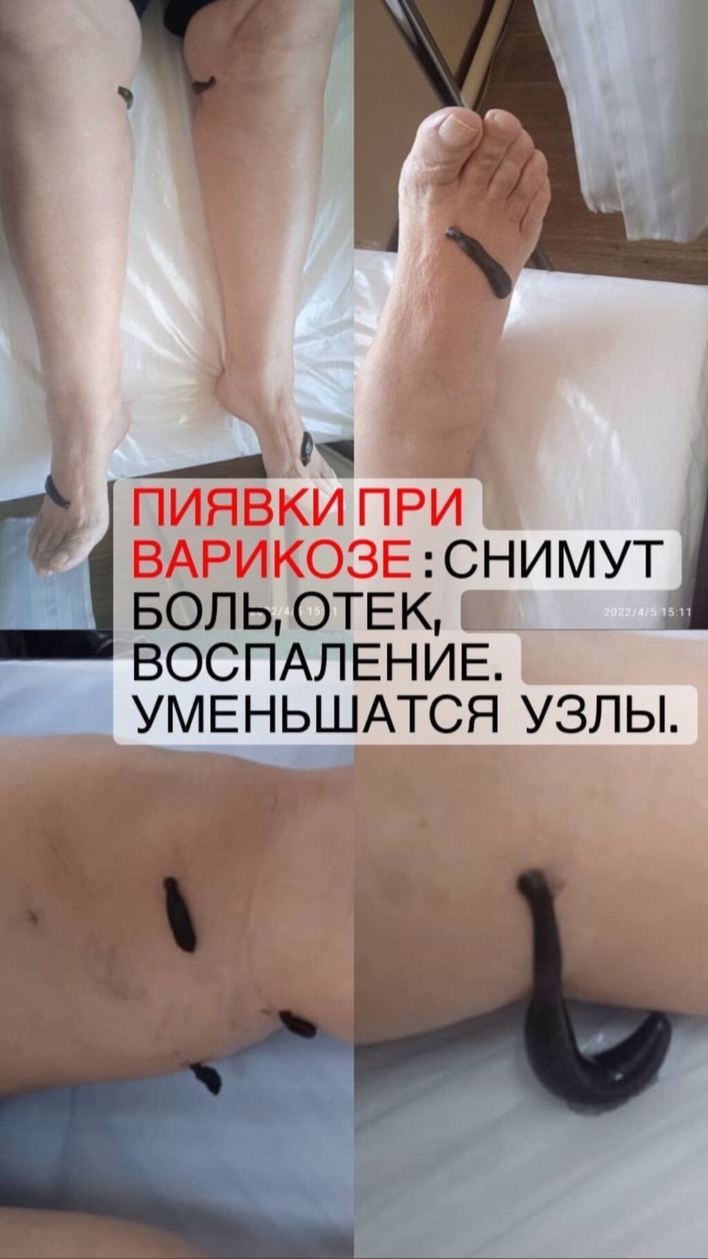 Требуется медсестра в медицинский центр (Бишкек Парк ТРЦ): фото 3