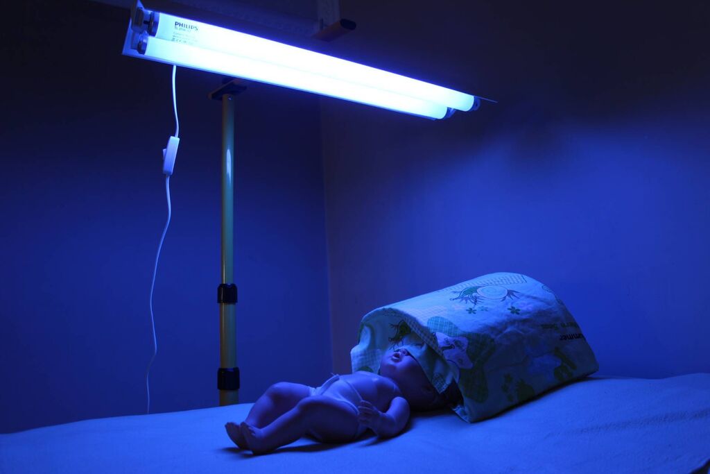 Прокат ламп. Лампа для фототерапии "Phototherapy 4000. УФ лампа от желтушки для новорожденного. Лампа для фототерапии Amelux. Лампа от желтухи Филипс.